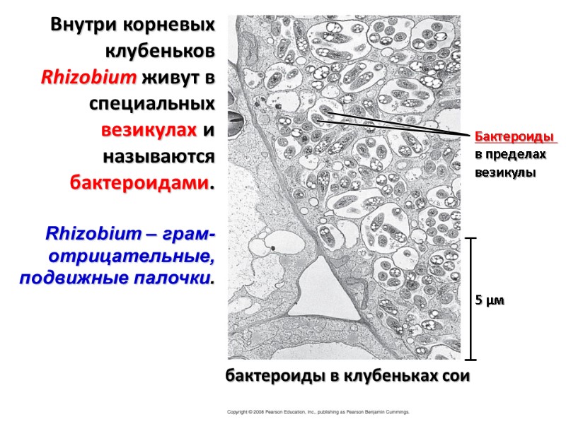 бактероиды в клубеньках сои 5 µм Бактероиды  в пределах  везикулы Внутри корневых